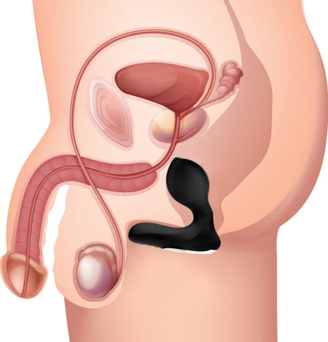 P-Swell 12x Inflatable "Prostate" Vibrator Anal Plug Little Sister's Book & Art Emporium P-Swell 12x Inflatable "Prostate" Vibrator Anal Plug Little Sister's Book & Art Emporium